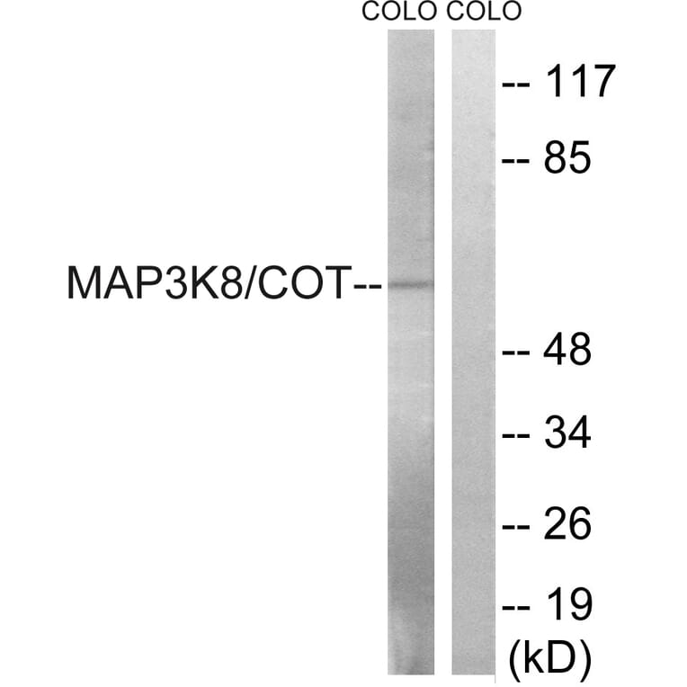 Western Blot - Anti-MAP3K8 Antibody (B8134) - Antibodies.com