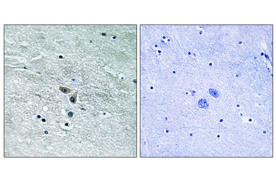 Immunohistochemistry - Anti-MAP3K8 Antibody (B8134) - Antibodies.com