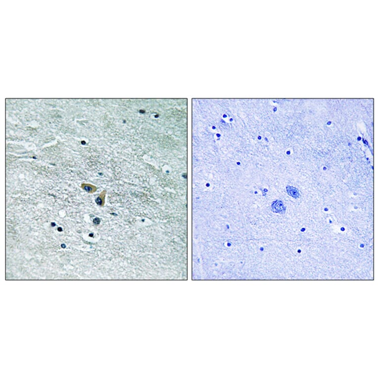 Immunohistochemistry - Anti-MAP3K8 Antibody (B8134) - Antibodies.com