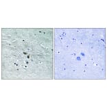 Immunohistochemistry - Anti-MAP3K8 Antibody (B8134) - Antibodies.com