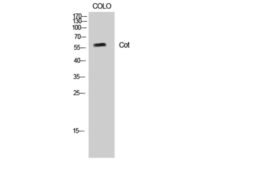 Western Blot - Anti-MAP3K8 Antibody (B8134) - Antibodies.com