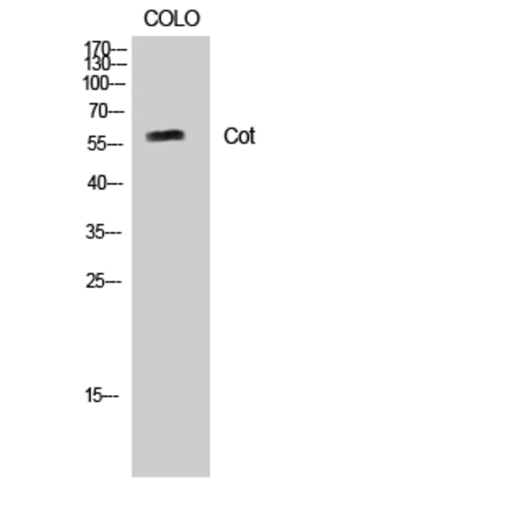 Western Blot - Anti-MAP3K8 Antibody (B8134) - Antibodies.com