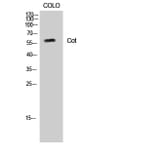 Western Blot - Anti-MAP3K8 Antibody (B8134) - Antibodies.com