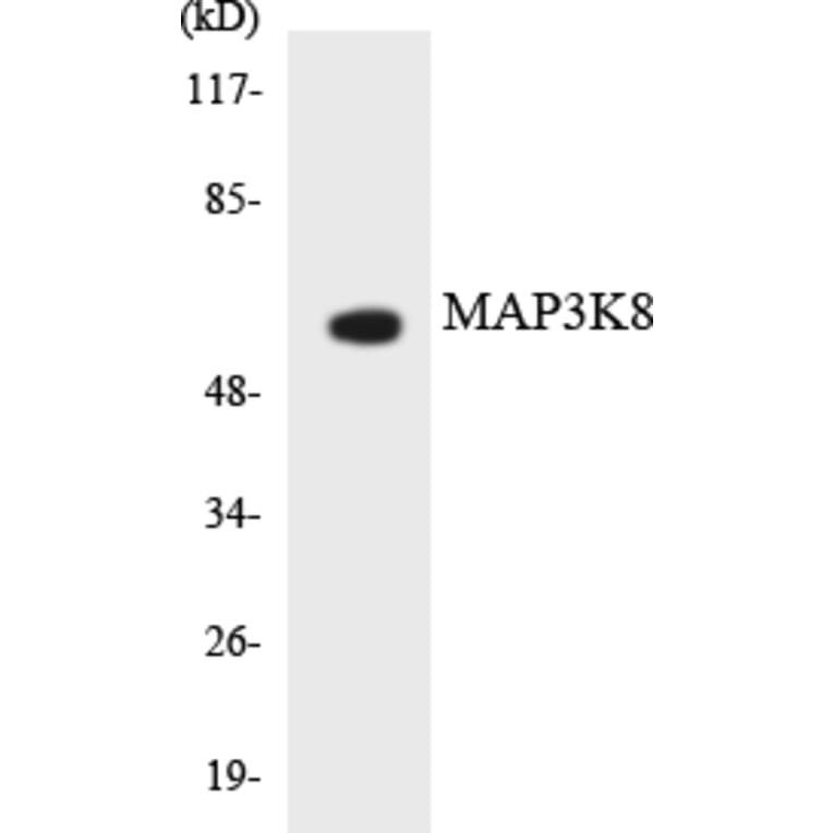 Western Blot - Anti-MAP3K8 Antibody (R12-2990) - Antibodies.com