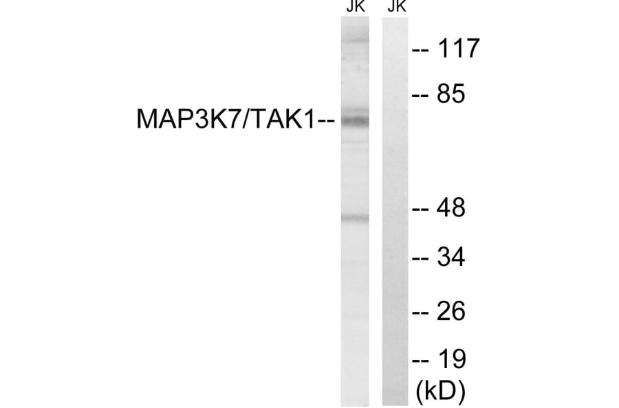 Western Blot - Anti-MAP3K7 Antibody (B8132) - Antibodies.com