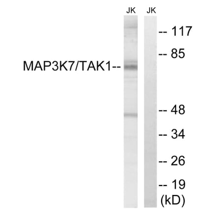 Western Blot - Anti-MAP3K7 Antibody (B8132) - Antibodies.com