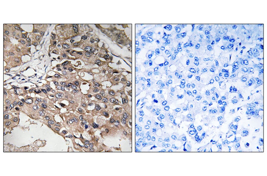 Immunohistochemistry - Anti-MAP3K7 Antibody (B8132) - Antibodies.com