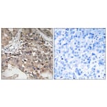 Immunohistochemistry - Anti-MAP3K7 Antibody (B8132) - Antibodies.com
