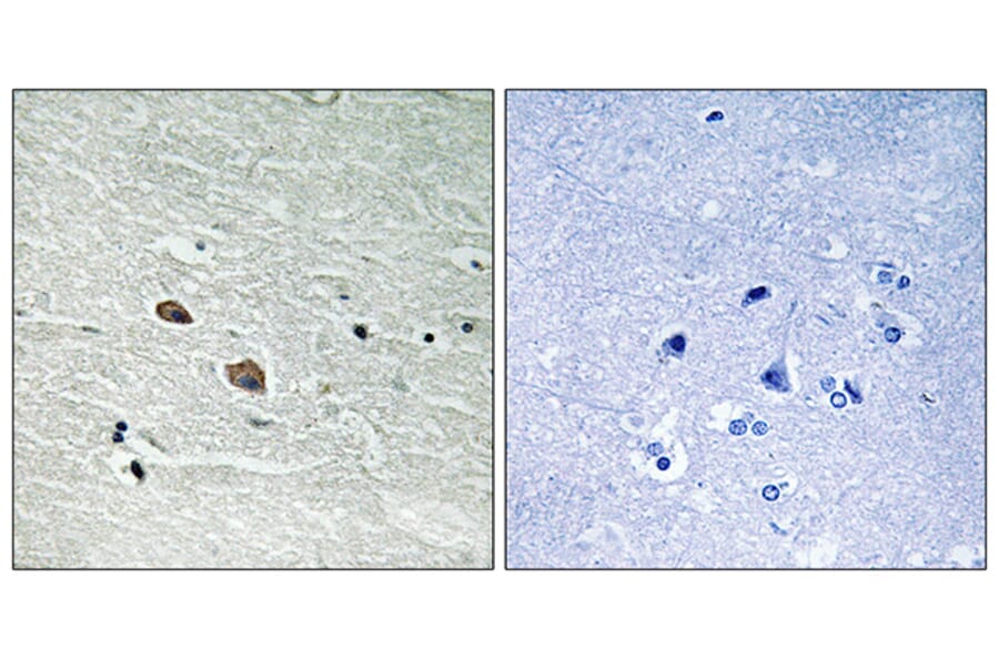Immunohistochemistry - Anti-MAP3K7 Antibody (B8133) - Antibodies.com
