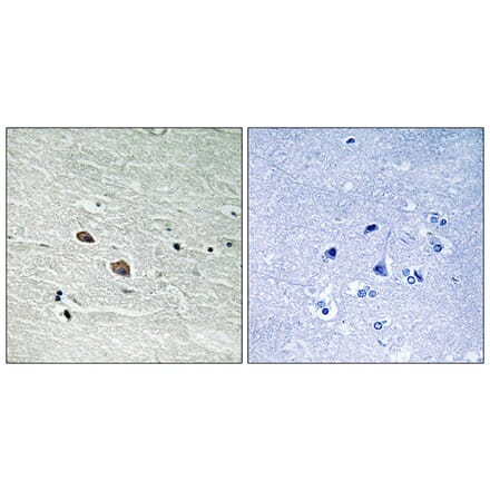 Immunohistochemistry - Anti-MAP3K7 Antibody (B8133) - Antibodies.com