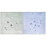 Immunohistochemistry - Anti-MAP3K7 Antibody (B8133) - Antibodies.com