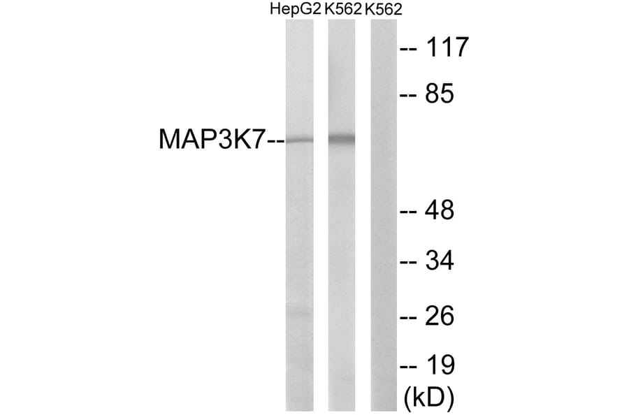 Western Blot - Anti-MAP3K7 Antibody (B8133) - Antibodies.com