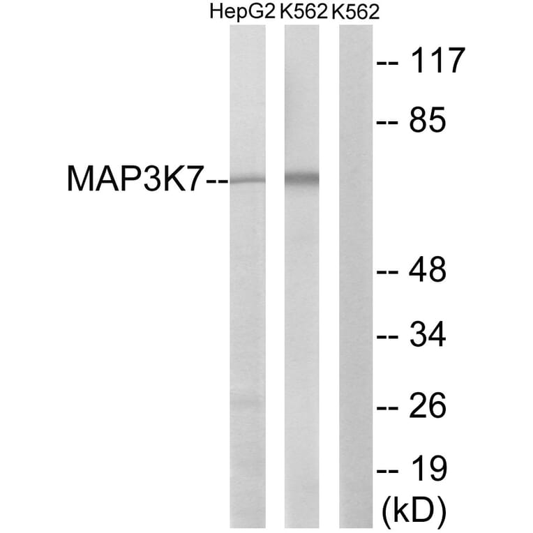 Western Blot - Anti-MAP3K7 Antibody (B8133) - Antibodies.com