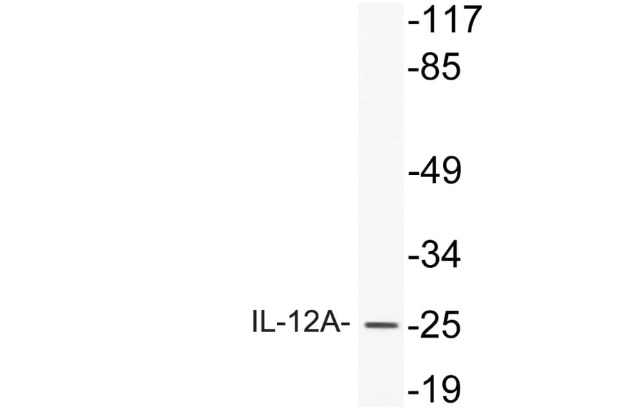 Western Blot - Anti-IL-12A Antibody (R12-2200) - Antibodies.com