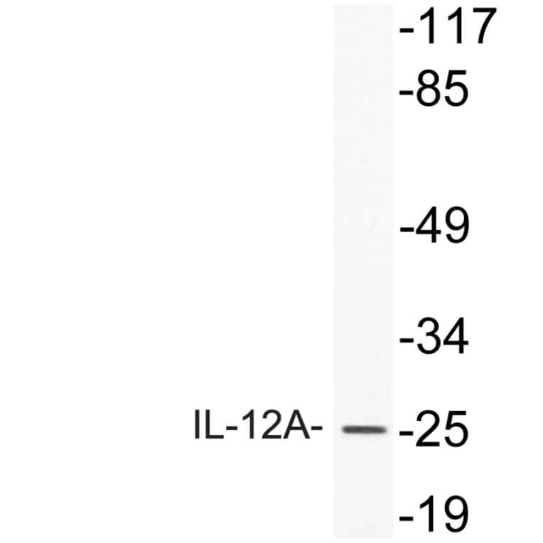 Western Blot - Anti-IL-12A Antibody (R12-2200) - Antibodies.com