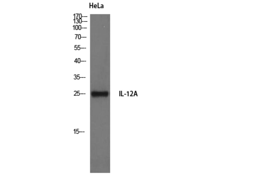 Western Blot - Anti-IL-12A Antibody (R12-2200) - Antibodies.com