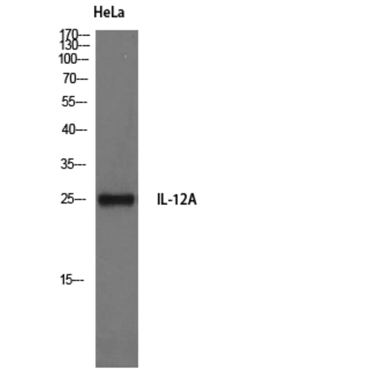 Western Blot - Anti-IL-12A Antibody (R12-2200) - Antibodies.com