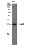 Western Blot - Anti-IL-12A Antibody (R12-2200) - Antibodies.com