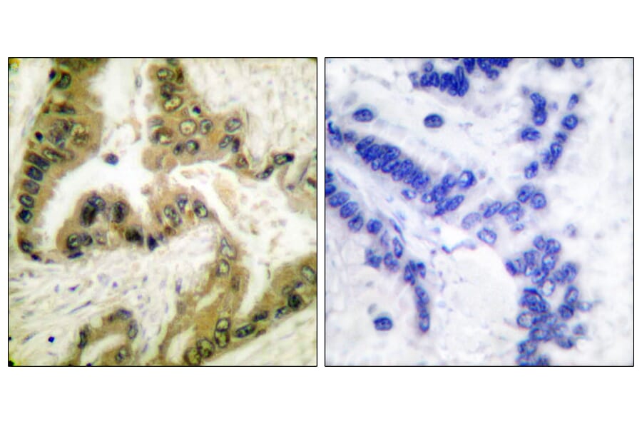 Immunohistochemistry - Anti-HDAC10 Antibody (C0222) - Antibodies.com