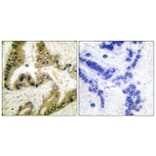 Immunohistochemistry - Anti-HDAC10 Antibody (C0222) - Antibodies.com