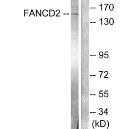 Western Blot - Anti-FANCD2 Antibody (B0427) - Antibodies.com