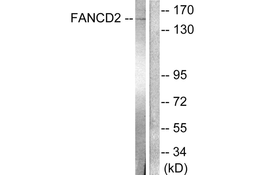 Western Blot - Anti-FANCD2 Antibody (B0427) - Antibodies.com