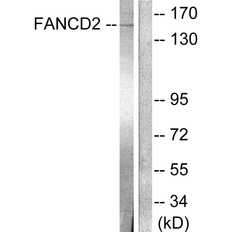 Western Blot - Anti-FANCD2 Antibody (B0427) - Antibodies.com