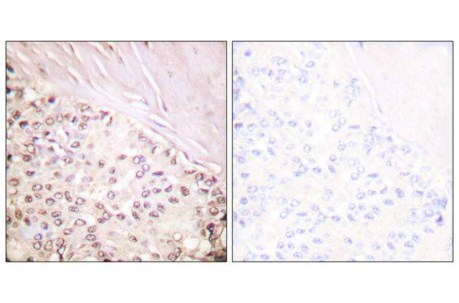 Immunohistochemistry - Anti-FANCD2 Antibody (B0427) - Antibodies.com