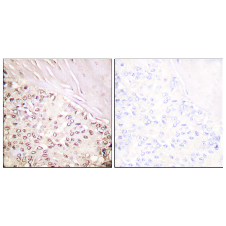 Immunohistochemistry - Anti-FANCD2 Antibody (B0427) - Antibodies.com