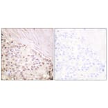 Immunohistochemistry - Anti-FANCD2 Antibody (B0427) - Antibodies.com