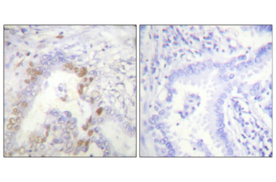 Immunohistochemistry - Anti-FANCD2 Antibody (B0427) - Antibodies.com