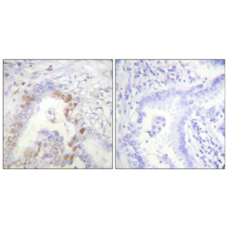 Immunohistochemistry - Anti-FANCD2 Antibody (B0427) - Antibodies.com
