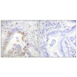 Immunohistochemistry - Anti-FANCD2 Antibody (B0427) - Antibodies.com