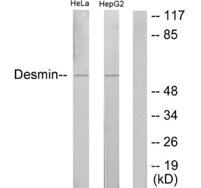 Western Blot - Anti-Desmin Antibody (B1196) - Antibodies.com