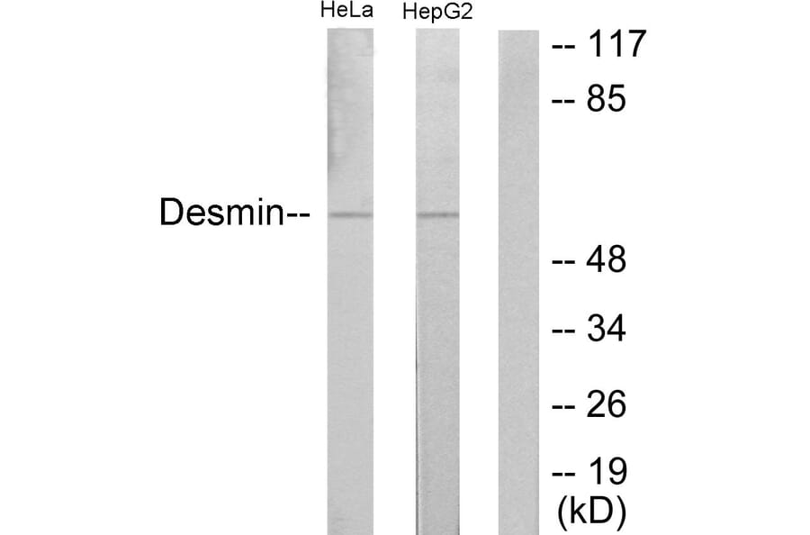Western Blot - Anti-Desmin Antibody (B1196) - Antibodies.com
