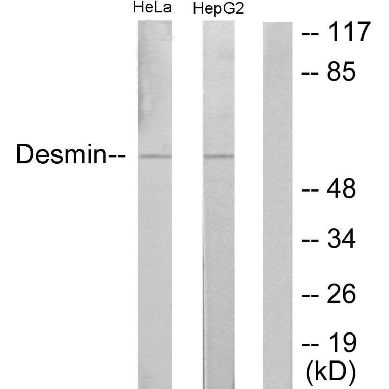 Western Blot - Anti-Desmin Antibody (B1196) - Antibodies.com