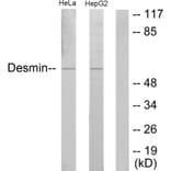 Western Blot - Anti-Desmin Antibody (B1196) - Antibodies.com