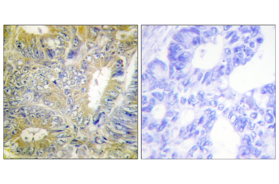 Immunohistochemistry - Anti-Desmin Antibody (B1196) - Antibodies.com