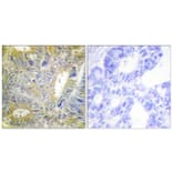 Immunohistochemistry - Anti-Desmin Antibody (B1196) - Antibodies.com