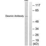 Western Blot - Anti-Desmin Antibody (C0171) - Antibodies.com