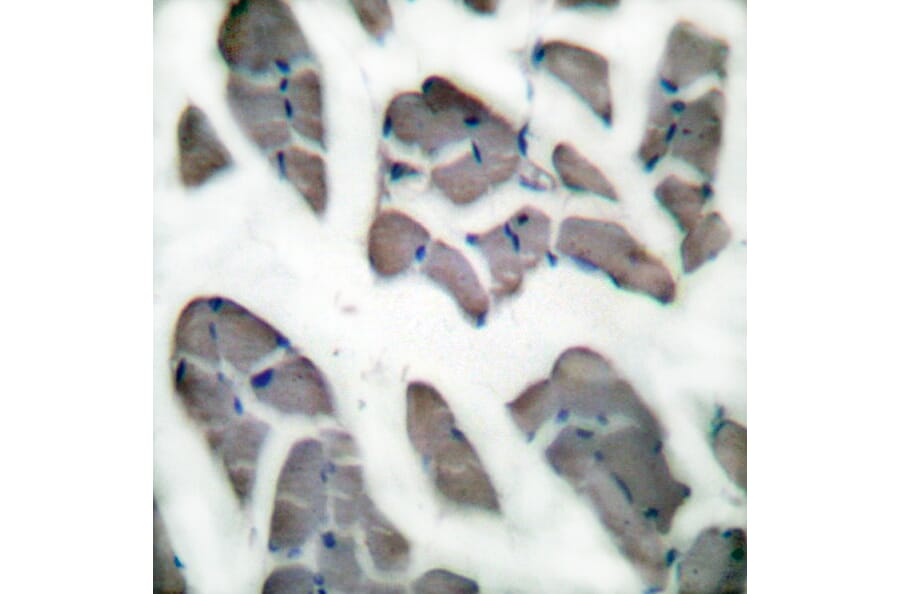 Immunohistochemistry - Anti-Desmin Antibody (C0171) - Antibodies.com
