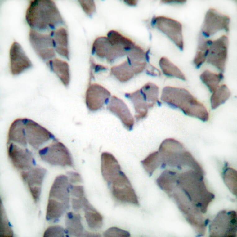 Immunohistochemistry - Anti-Desmin Antibody (C0171) - Antibodies.com