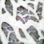 Immunohistochemistry - Anti-Desmin Antibody (C0171) - Antibodies.com