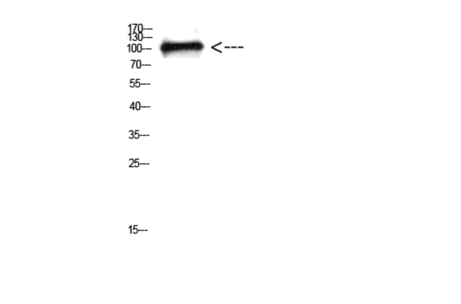 Western Blot - Anti-CTNND1 Antibody (C30834) - Antibodies.com