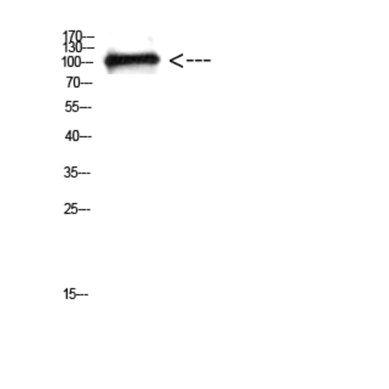 Western Blot - Anti-CTNND1 Antibody (C30834) - Antibodies.com