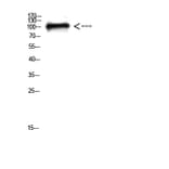 Western Blot - Anti-CTNND1 Antibody (C30834) - Antibodies.com