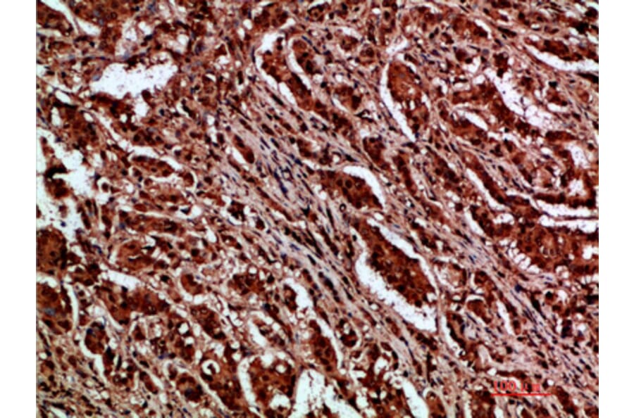 Immunohistochemistry - Anti-CTNND1 Antibody (C30834) - Antibodies.com