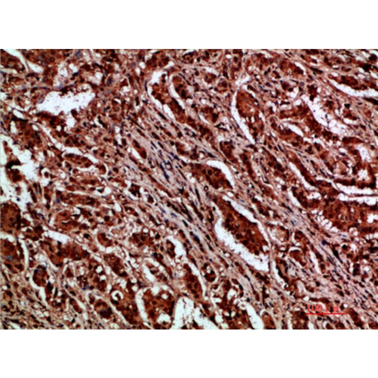 Immunohistochemistry - Anti-CTNND1 Antibody (C30834) - Antibodies.com