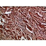 Immunohistochemistry - Anti-CTNND1 Antibody (C30834) - Antibodies.com