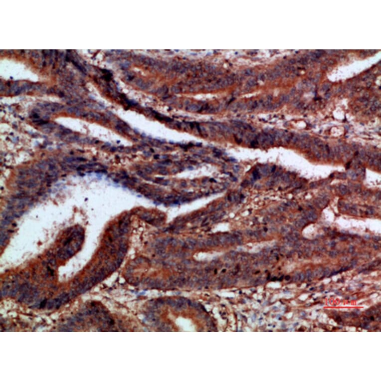 Immunohistochemistry - Anti-CTNND1 Antibody (C30834) - Antibodies.com